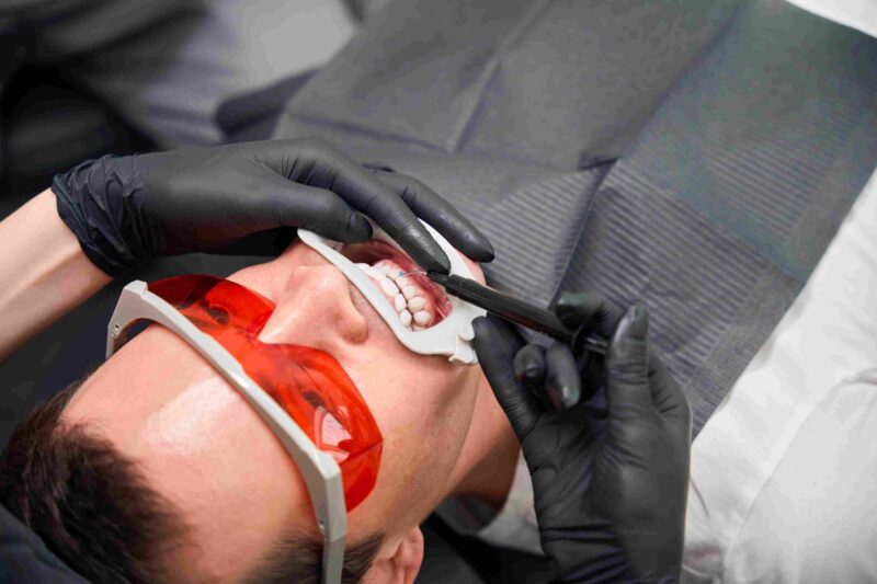 Patient receiving teeth whitening treatment with protective glasses at a dental clinic