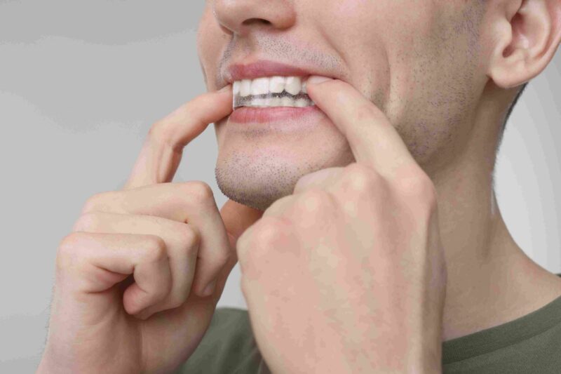 Person applying a whitening strip to teeth for at home treatment